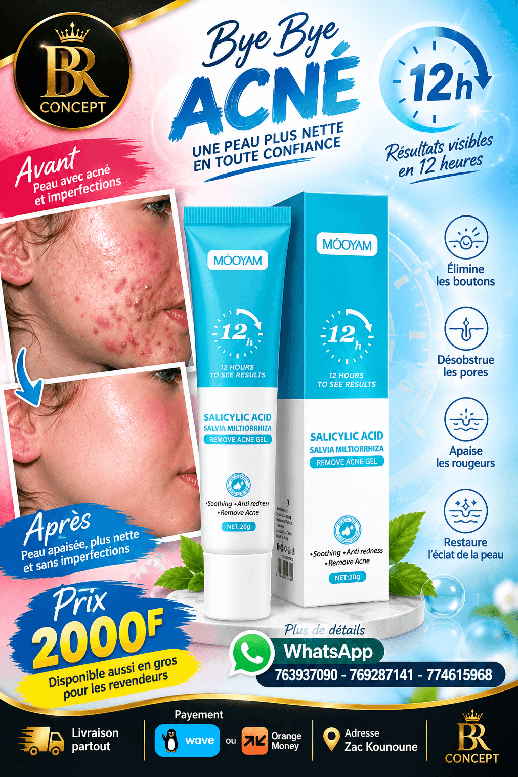 le Gel Anti-Acné Mooyam à l'Acide Salicylique. – BR Concept